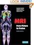 MRI from Picture to Proton
