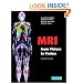 MRI from Picture to Proton