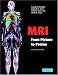 MRI from Picture to Proton