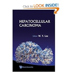 Hepatocellular Carcinoma