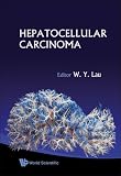 Hepatocellular Carcinoma
