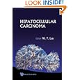 Hepatocellular Carcinoma