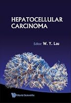Hepatocellular Carcinoma