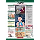 Diseases Explained: Chronic Obstructive Pulmonary Disease Wall Chart by  Lexi-Comp