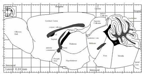 The Mouse Brain in Stereotaxic Coordinates (Deluxe Edition)