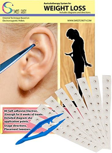 Auriculotherapy System for Weight Loss