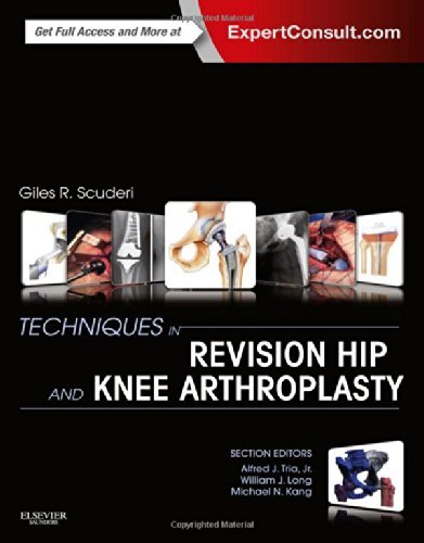 Techniques in Revision Hip and Knee Arthroplasty, 1e by Giles R Scuderi MD (30-May-2014) Hardcover