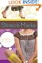 Stretch Marks: A Novel