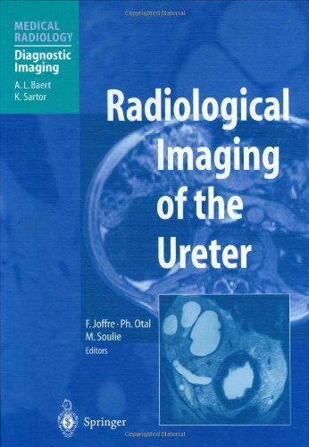 ureter