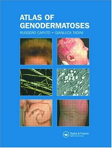 Dermatology