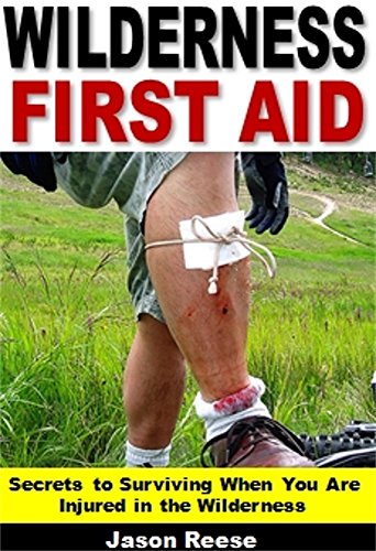 Wilderness First Aid: Secrets to Surviving When You Are Injured in the Wilderness