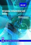 Intraocular inflammation and uveitis