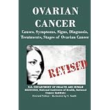 Ovarian Cancer: Causes, Symptoms, Signs, Diagnosis, Treatments, Stages of Ovarian Cancer