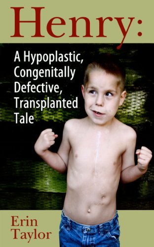 A Hypoplastic, Congenitally Defective, Transplanted Tale