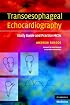 Transoesophageal Echocardiography: Study Guide and Practice MCQs