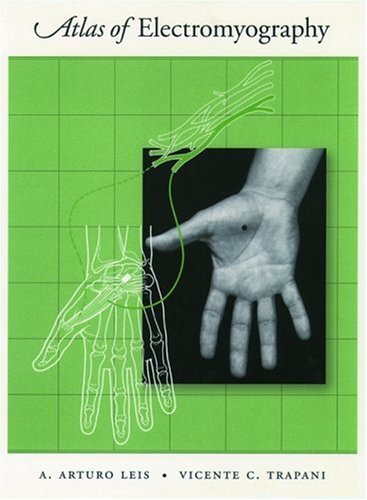 Muscle-Disorders