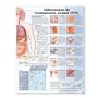 Sexually Transmitted Infections Anatomical Chart in Spanish (Infecciones de transmisión sexual)