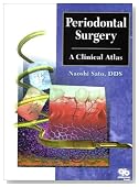 Periodontal Surgery: A Clinical Atlas