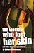 Book The Woman Who Lost Her Skin: (And Other Dermatological Tales)