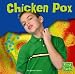 Chicken Pox (Health Matters)