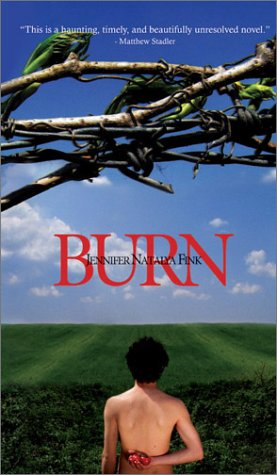 Burns