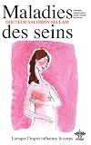 L'encyclop�die B�rangel des �tats d'�me � l'origine de nos maladies : Tome 2, Maladies des seins