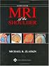 MRI of the Shoulder