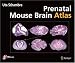 Prenatal Mouse Brain Atlas: Color images and annotated diagrams of: Gestational Days ...
