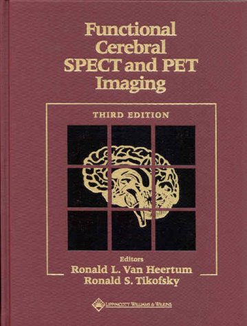 Neurological Disorders