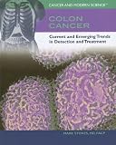  : Colon Cancer: Current And Emerging Trends In Detection And Treatment (Cancer and Modern Science)