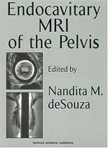 Endocavitary MRI of the Pelvis