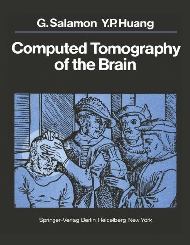 Computed Tomography of the Brain: Atlas of Normal Anatomy