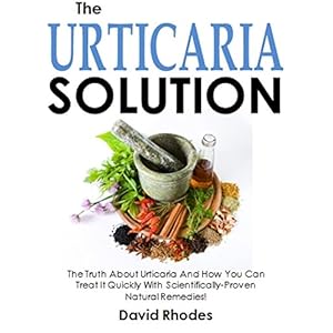 The Urticaria Solution: The Truth About Urticaria And How You Can  Treat It Quickly With Scientifically-Proven  Natural Remedies!