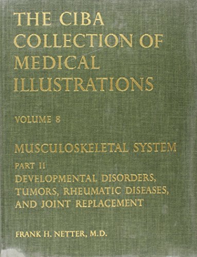 Musculoskeletal System: Developmental Disorders, Tumors, Rheumatic Diseases, and Joint Replacement (Netter Collection of Medical Illustrations, Volume 8, Part 2)