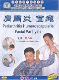 Periarthritis Humeroscapularis / Facial Paralysis (Chinese Medicine Massage Cures Diseases in Good Effects Series)