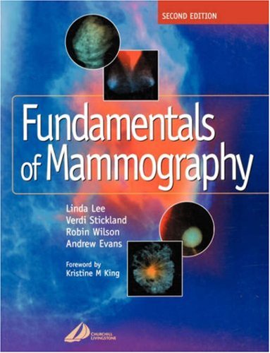 Fundamentals of Mammography