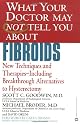 What Your Doctor May Not Tell You About Fibroids