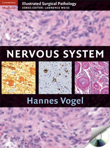 nervous system cambridge illustrated surgical pathology