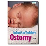 Caring for an Infant's or Toddler's Ostomy (Colostomy) by 