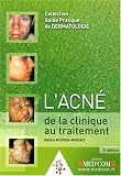 L'acn� de la clinique au traitement
