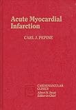 Acute myocardial infarction