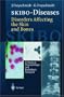 SKIBO-Diseases Disorders Affecting the Skin and Bones: A Clinical, Dermatologic, and Radiologic Synopsis