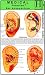 Ear Acupuncture - Medical Pocket Card
