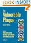 The Vulnerable Plaque, Second Edition