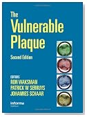 The Vulnerable Plaque, Second Edition