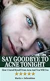 Say Goodbye to Acne Tonight - How I Cured Myself From Acne And You Will Too