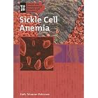 Sickle Cell Anemia (Genetic and Developmental Diseases and Disorders) by Judy Monroe Peterson