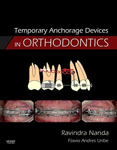 Temporary Anchorage Devices in Orthodontics, 1e 1st Edition by Nanda BDS MDS PhD, Ravindra (2008) Hardcover