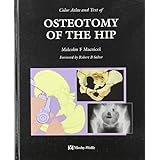 color atlas and text of osteotomy of the hip 1e