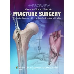 Click here to buy Harborview Illustrated Tips and Tricks in Fracture Surgery by Michael J Gardner, Robert Dunbar, M. Henley, and Sean Nork.